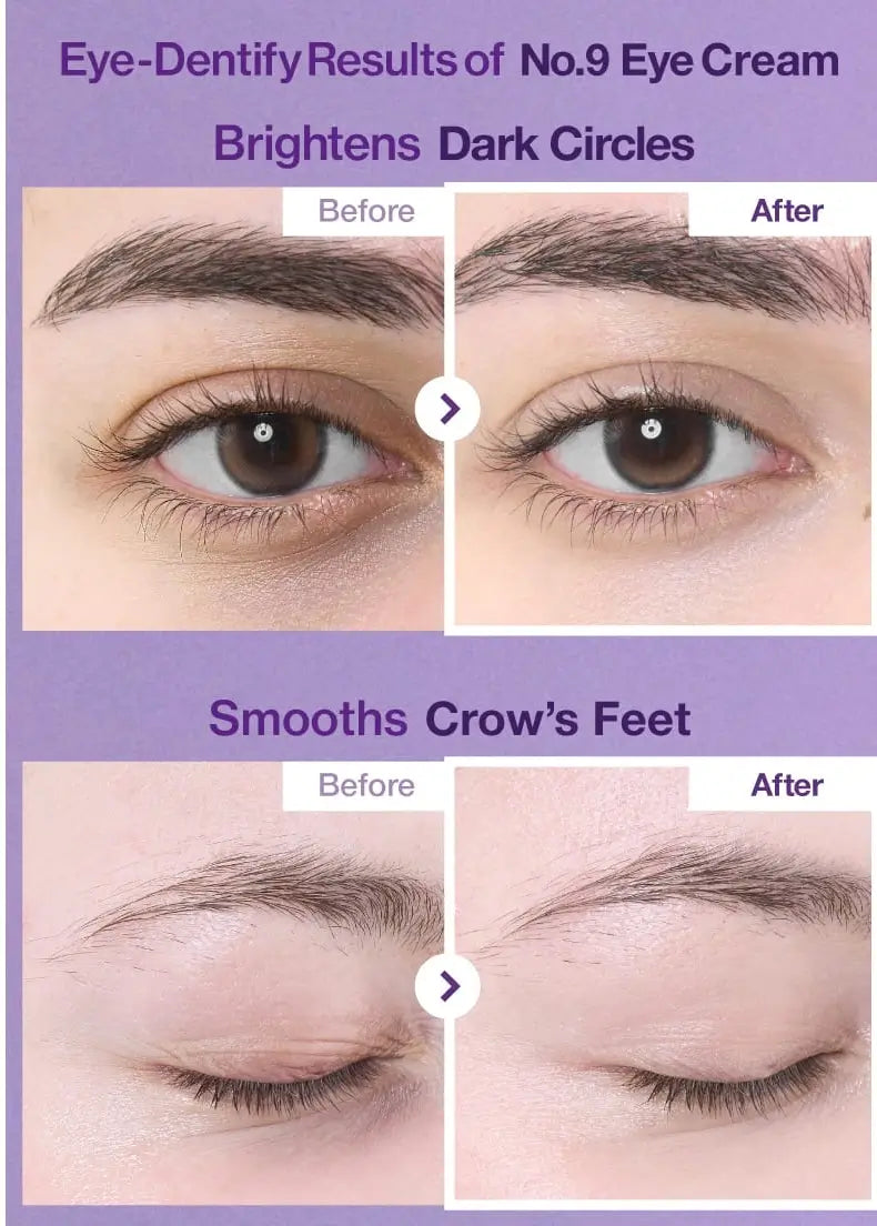 Numbuzin No.9 NAD+ Retinol Voumetox Eye Cream